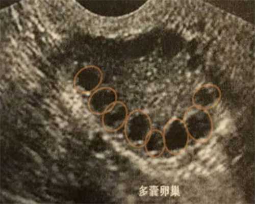 供卵试管子宫的条件，内膜厚度不够标准真做不了